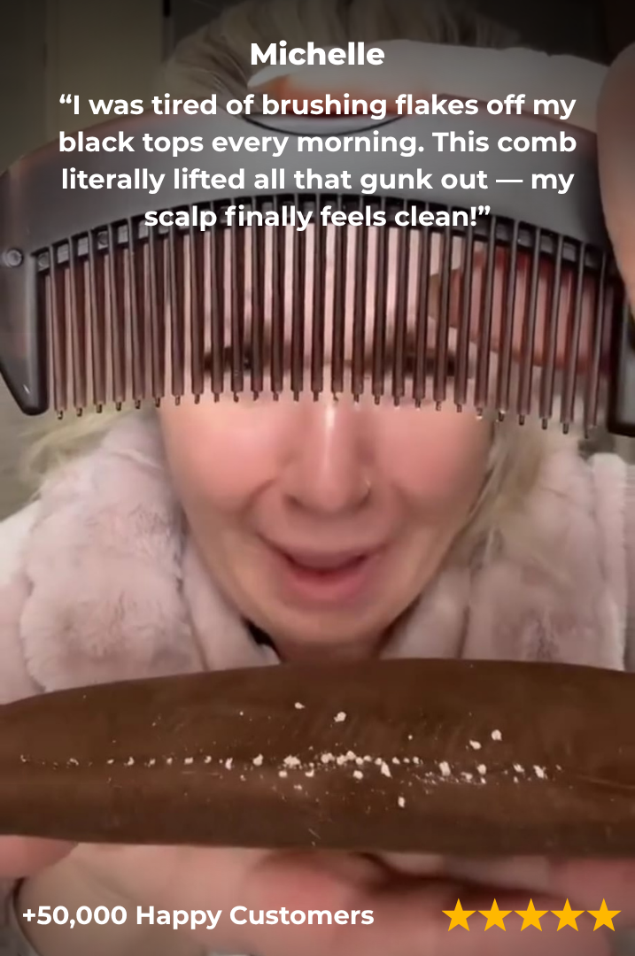 Dandruff Comb