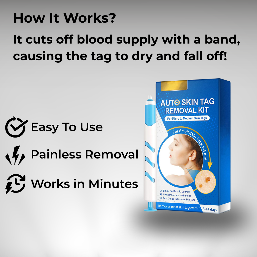 Auto Skin Tag Removal Kit