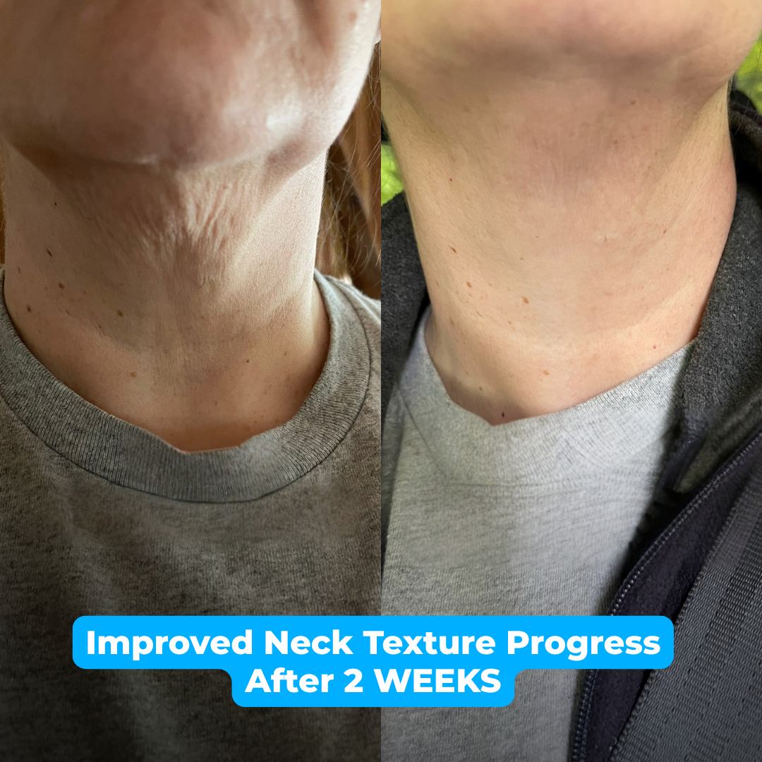 Lakerain® Firming Cream