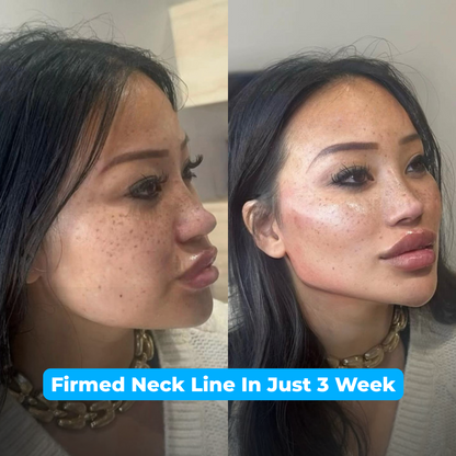 Lakerain® Firming Cream