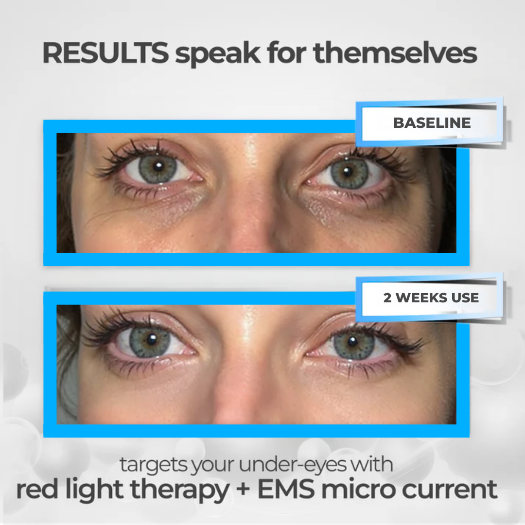 GlowEye™ EMS Therapy Device