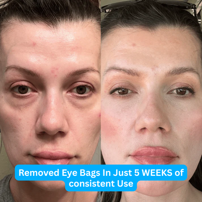 GlowEye™ EMS Therapy Device