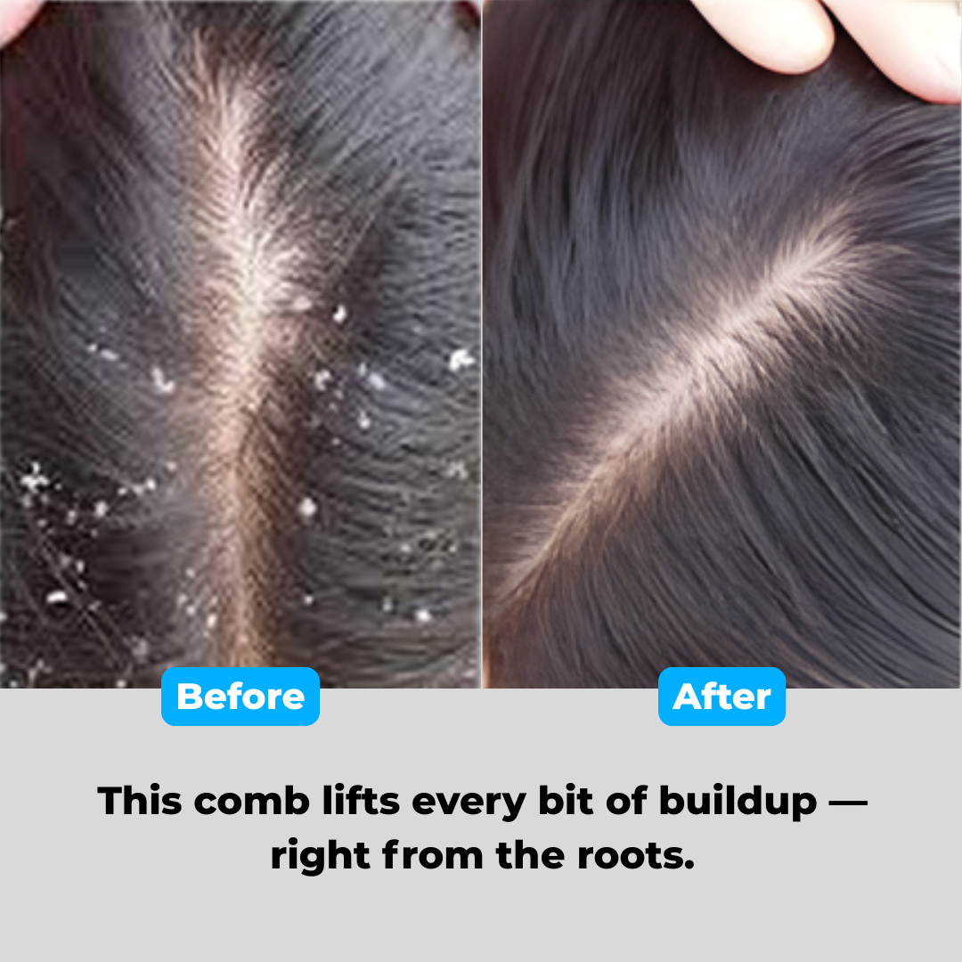 Dandruff Comb