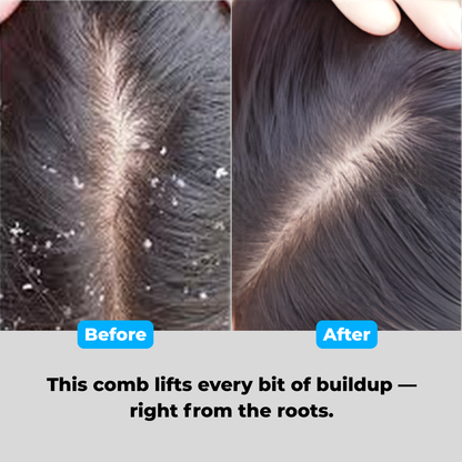 Dandruff Comb