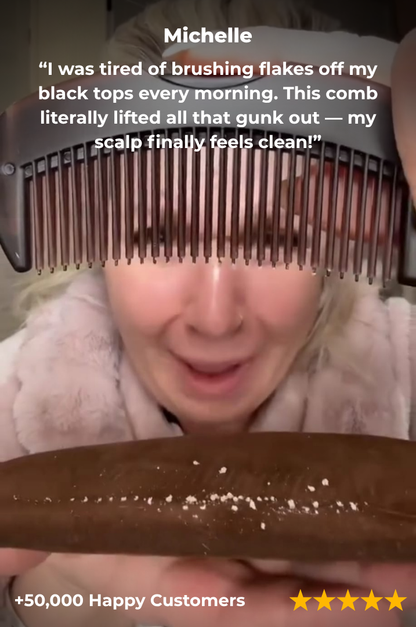 Dandruff Comb