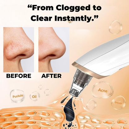 Pore Cleaner