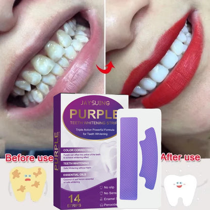 Free Teeth Whitening Strips