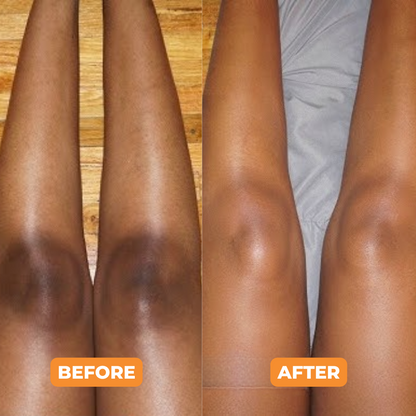 Gmeelan™- Whitening Gel