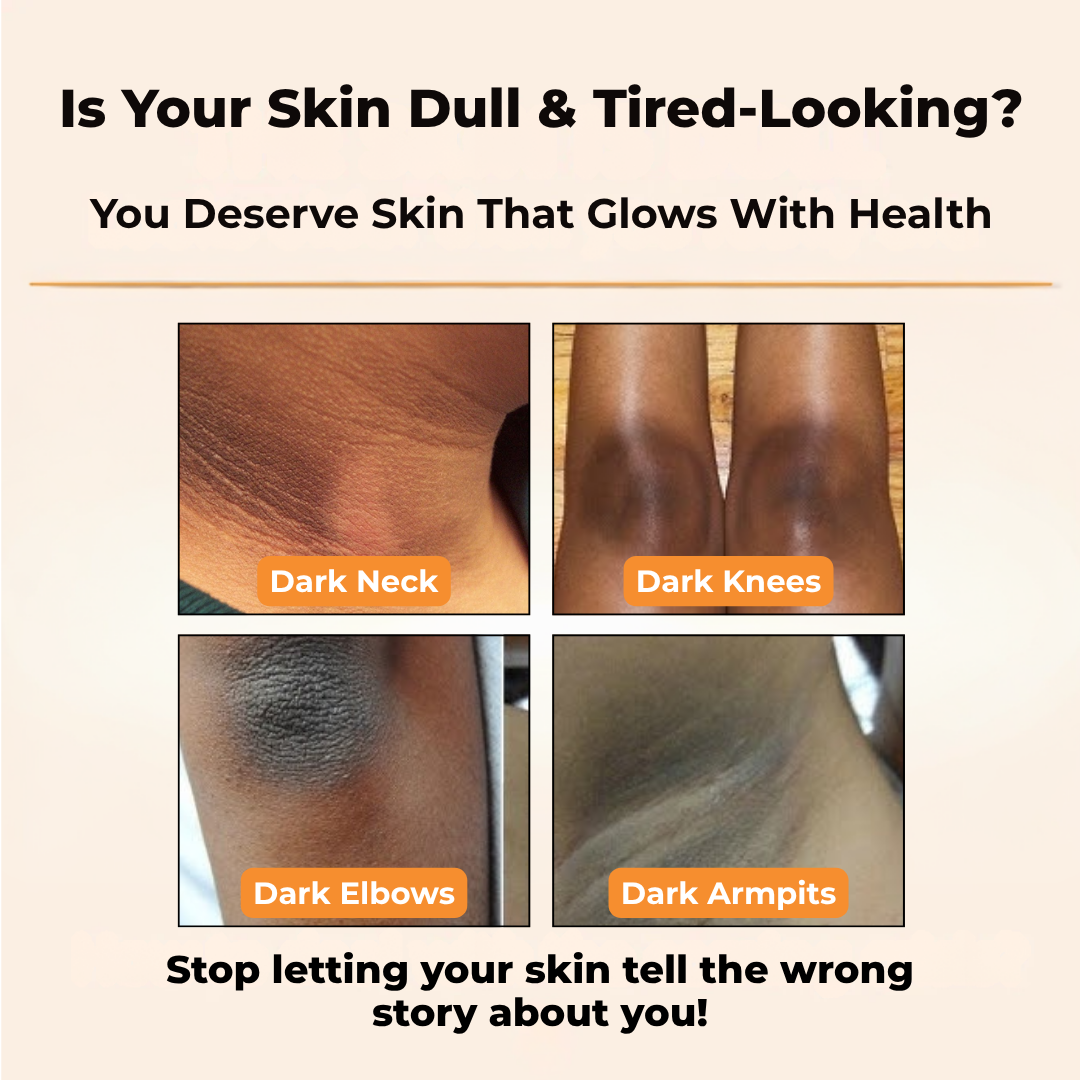 Gmeelan™- Whitening Gel