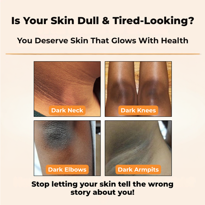 Gmeelan™- Whitening Gel