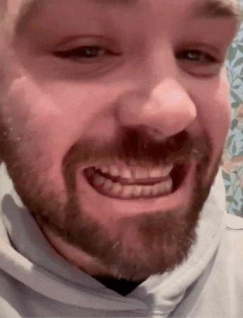 Instant Smile Magic Veneers