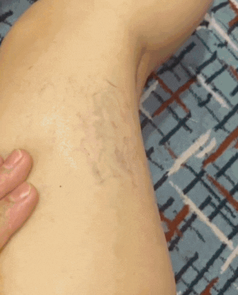 Revive Leg Massager Boots