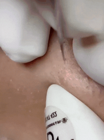 GlowVac Pore Cleaner