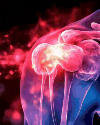 Retexes Shoulder Comfort Sleeve