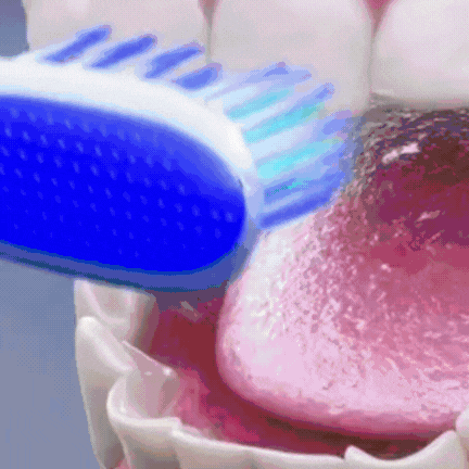 30-Second Smile Sonic Toothbrush